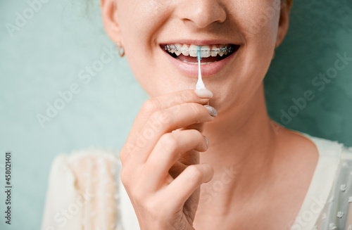 Wallpaper Mural Close up of woman using elastic cleaning toothpick while brushing teeth with orthodontic brackets. Woman cleaning teeth with dental floss brush. Concept of dentistry, hygiene and dental care. Torontodigital.ca