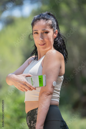 Diabetic woman demonstrating glucose monitoring and checking with remote sensor and smartphone
