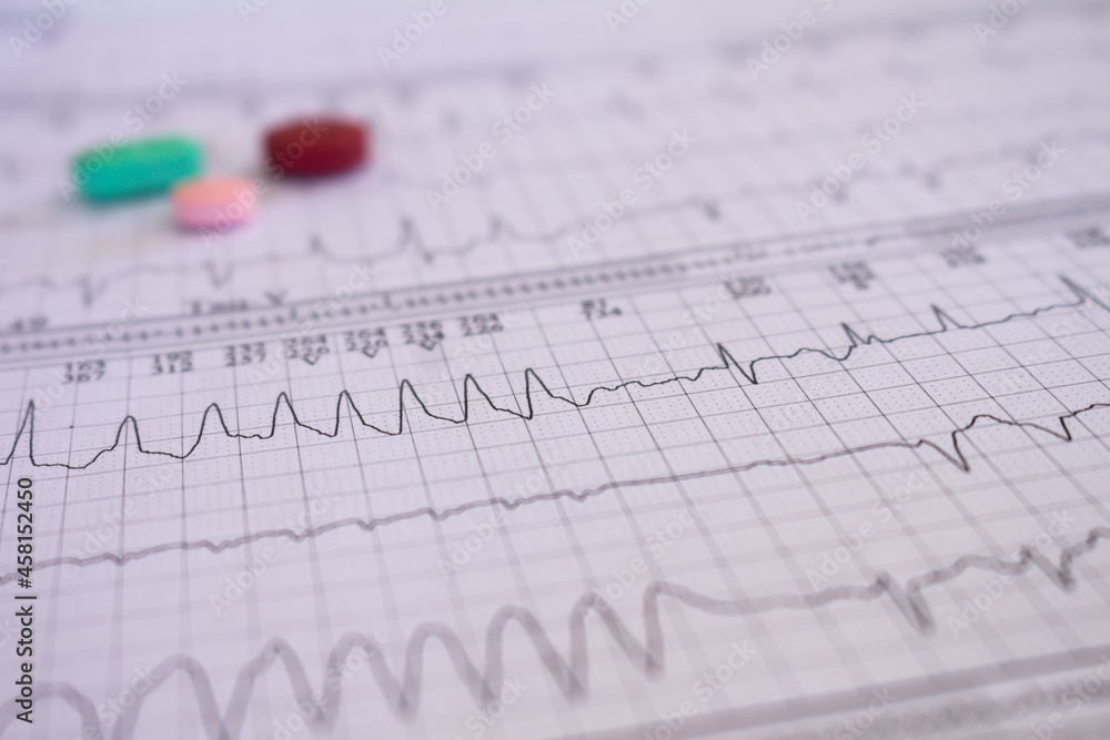 Heartbeat recorded on paper. Cardiovascular study. Heartbeat recorded on paper. Cardiovascular study.