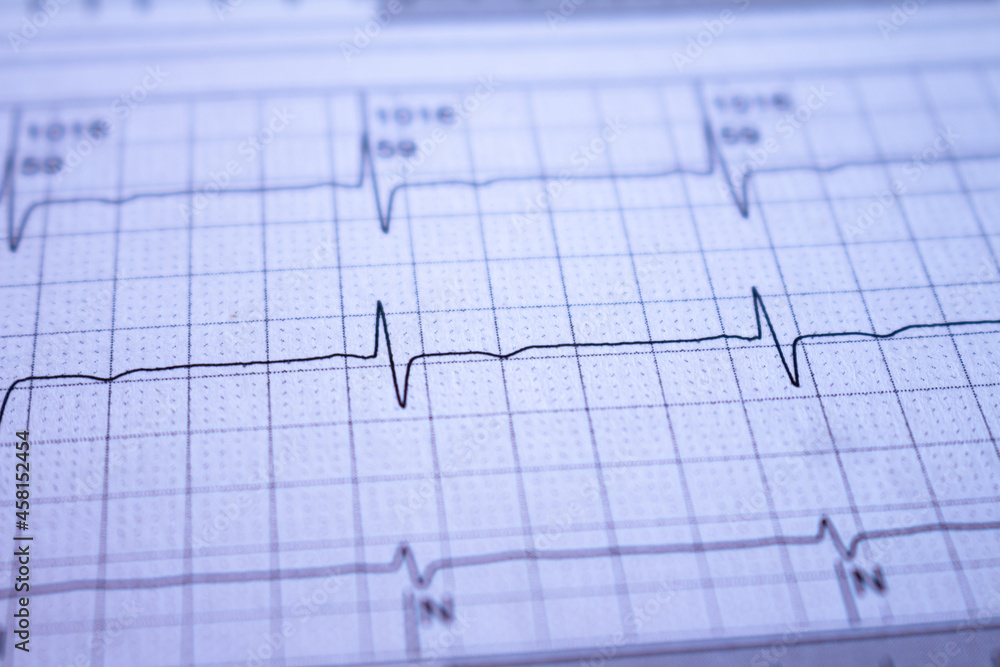 Heartbeat recorded on paper. Cardiovascular study. Heartbeat recorded on paper. Cardiovascular study.