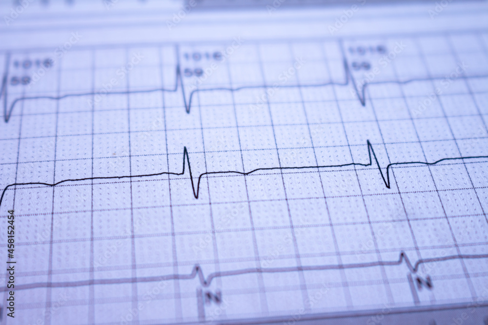 Heartbeat recorded on paper. Cardiovascular study.