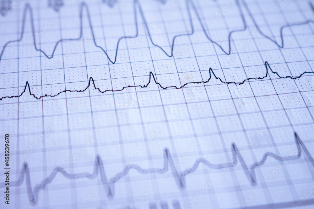 Close-up on an electrocardiogram. Heartbeat written on paper. Study of the heart.
