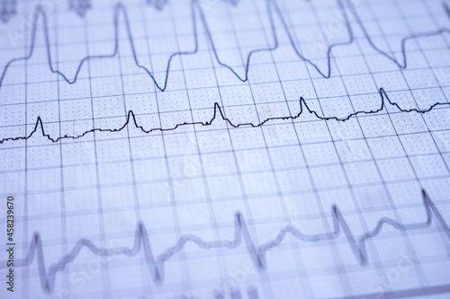 Close-up on an electrocardiogram. Heartbeat written on paper. Study of the heart.