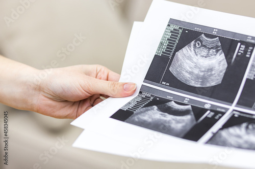 Close up photo of hand holding ultrasound result.