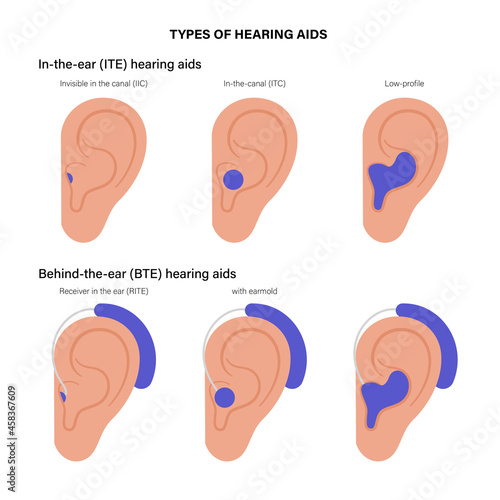 Hearing aids types