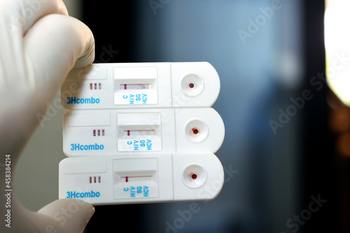 Rapid test cassette kit for Hepatitis C virus antibodies HCV AB, Human Immune virus HIV AIDS test and HBsAG Hepatitis B surface antigen with negative result done by a blood sample and a reagent  photo