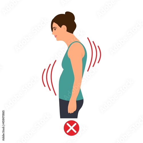 Incorrect standing posture.Young woman with bad posture. Cervical spinal curvature. Hump. Healthy back.Vector illustration on white background.