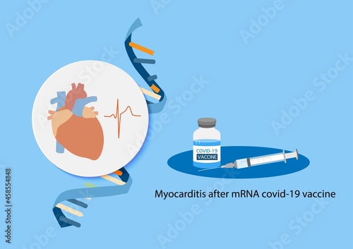 Myocarditis after mRNA covid-19 vaccination