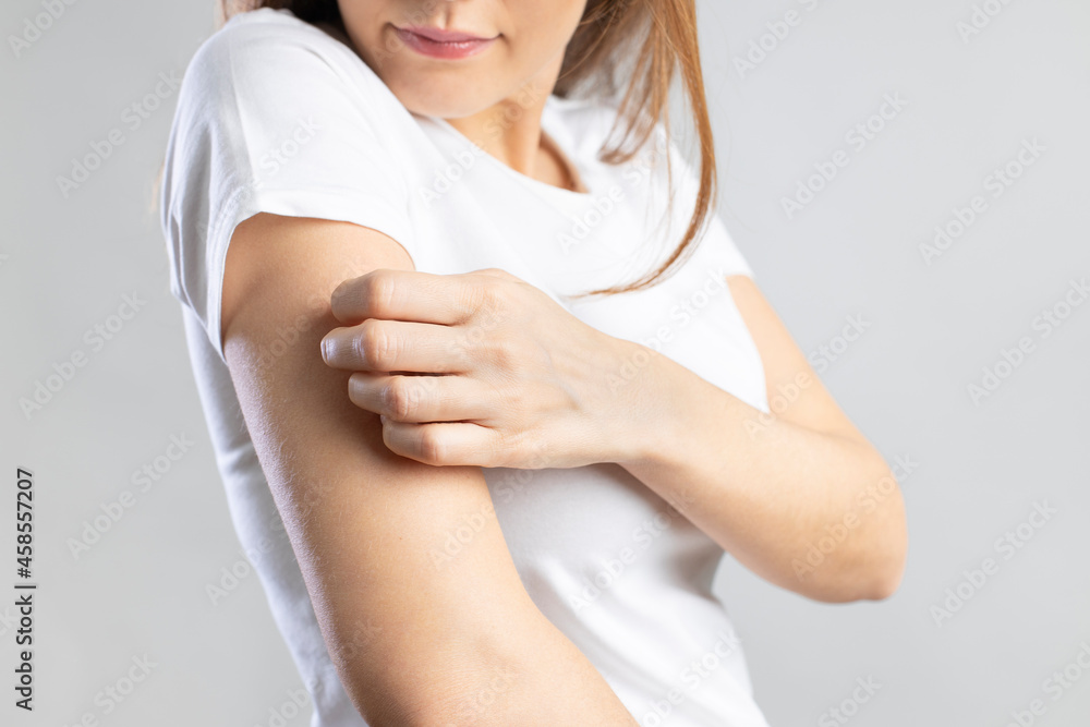 Young woman scratching her itchy arm.