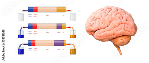 Brain, mass, arterial volume, venous volume, CSF - cerebrospinal fluid acronym, medical concept background, 3d render photo