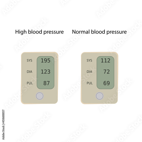Hypertension, normal and high blood pressure. Tonometer. Flat vector medical illustration.