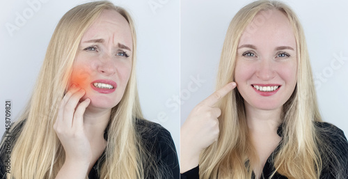 Before and after. On the left  the woman indicates teeth pain  and on the right  indicates that the teeth no longer hurts. Toothache. Pain management and professional medical care assistance concept.