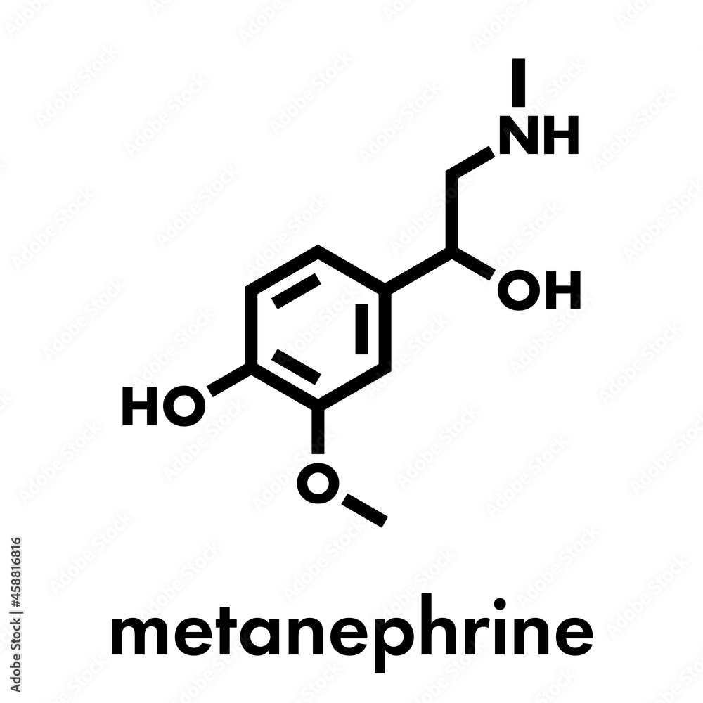 Metanephrine (metadrenaline) molecule. Metabolite of epinephrine that is biomarker for pheochromocytoma. Skeletal formula. Metanephrine (metadrenaline) molecule. Metabolite of epinephrine that is biomarker for pheochromocytoma. Skeletal formula.