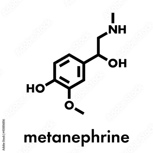 Metanephrine (metadrenaline) molecule. Metabolite of epinephrine that is biomarker for pheochromocytoma. Skeletal formula.