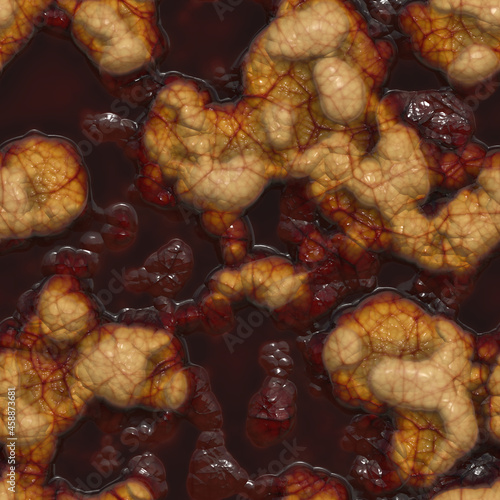 Wet blood surrounding a cancerous tumour 3D illustration