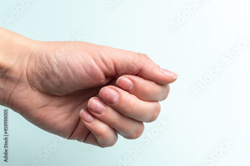 Close-up of a Caucasian female hand with natural unpolished nails, overgrown cuticle on a white background
