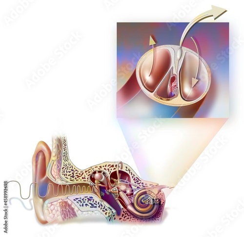 Anatomy of the ear showing the eardrum, ossicles, hammer. . photo