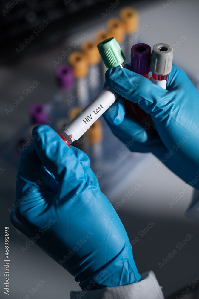 Blood tests to detect sexually transmitted diseases or STDs hepatitis