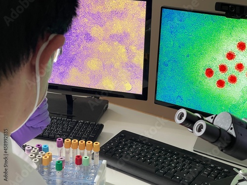 Laboratory technician doing research with images of hepatitis a virus on computer. photo