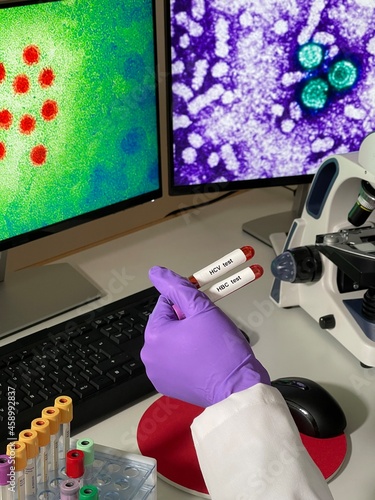 Laboratory assistant doing research with images of hepatitis a and b virus on computer. photo