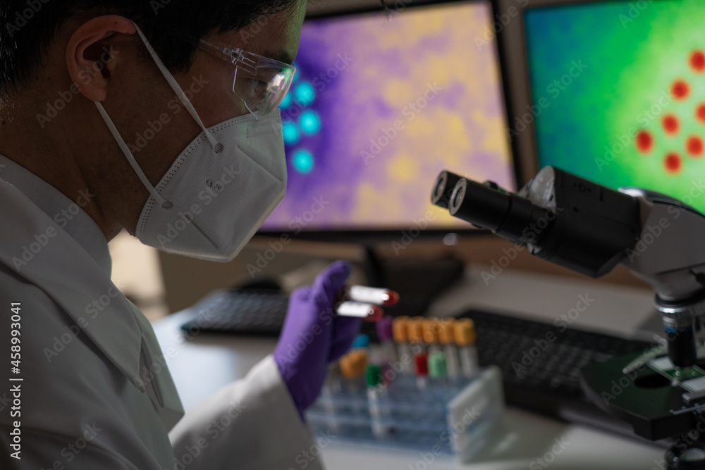 Blood tests to detect hepatitis b (HBC) and c (HCV), viruses visible on the screen. Blood tests to detect hepatitis b (HBC) and c (HCV), viruses visible on the screen.