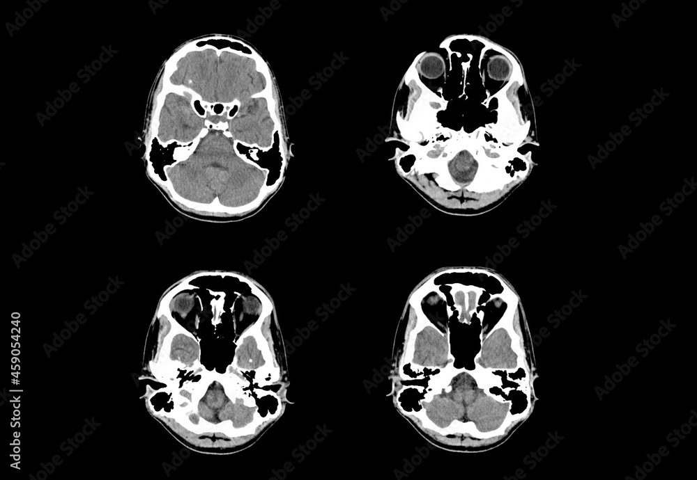 Brain ct scan and MRI professional images Brain ct scan and MRI professional images