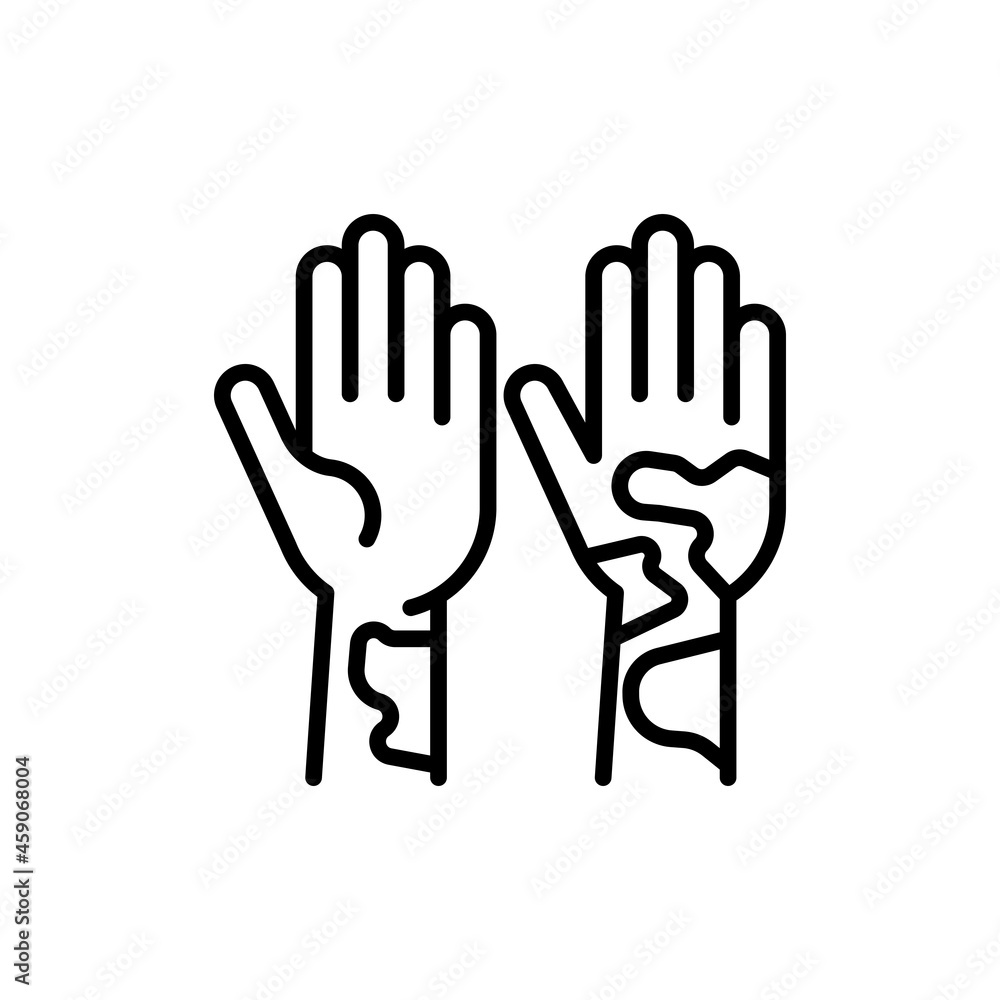 Hives on hand thin line icon. Allergy symptom. Modern vector illustration of allergic reaction. Hives on hand thin line icon. Allergy symptom. Modern vector illustration of allergic reaction.