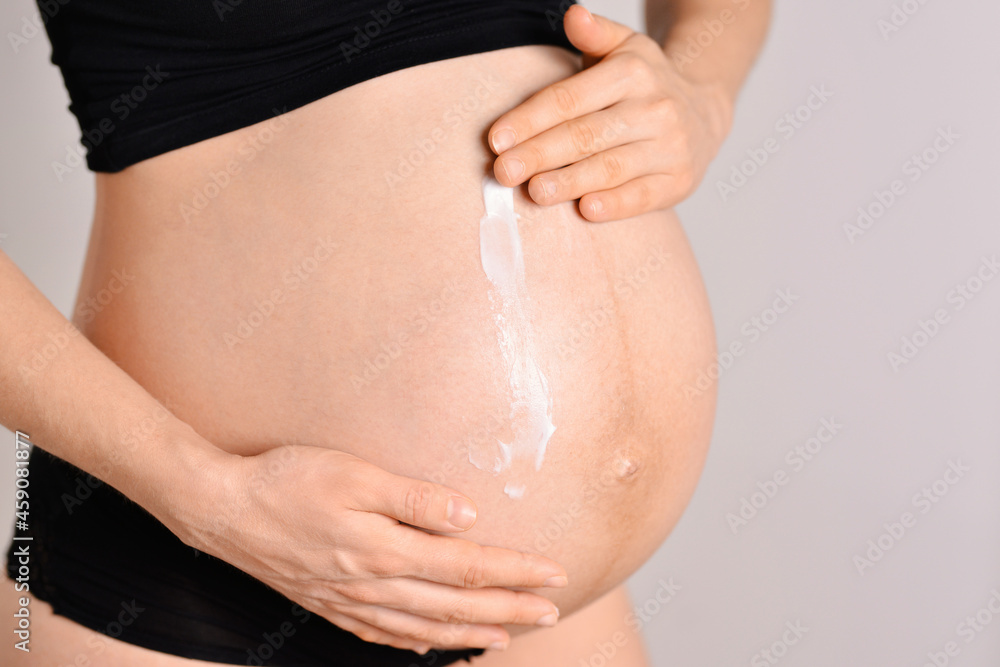 Pregnant woman applying cream at her belly for prevention of stretch