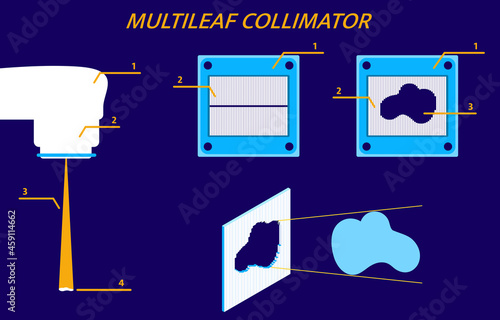 Multileaf collimator of linear accelerator (linac).  Vector  flat  illustration in a minimalist style.