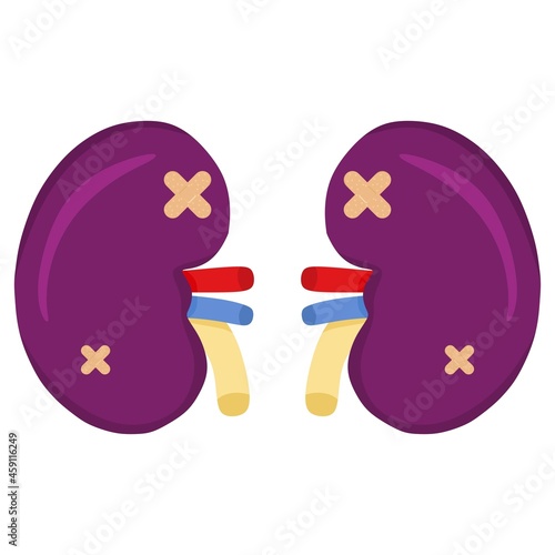 Vector illustration of a kidney with a diseased condition, suitable for advertising health and education products