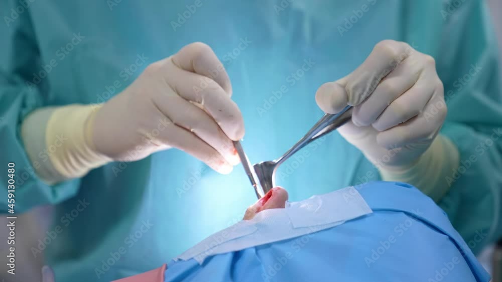 Surgical procedure in a nose. Surgeon using sterile surgical instrument