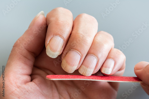 Main de femme se limant les ongles, en gros plan
Ongles striés, abîmés, desséchés photo