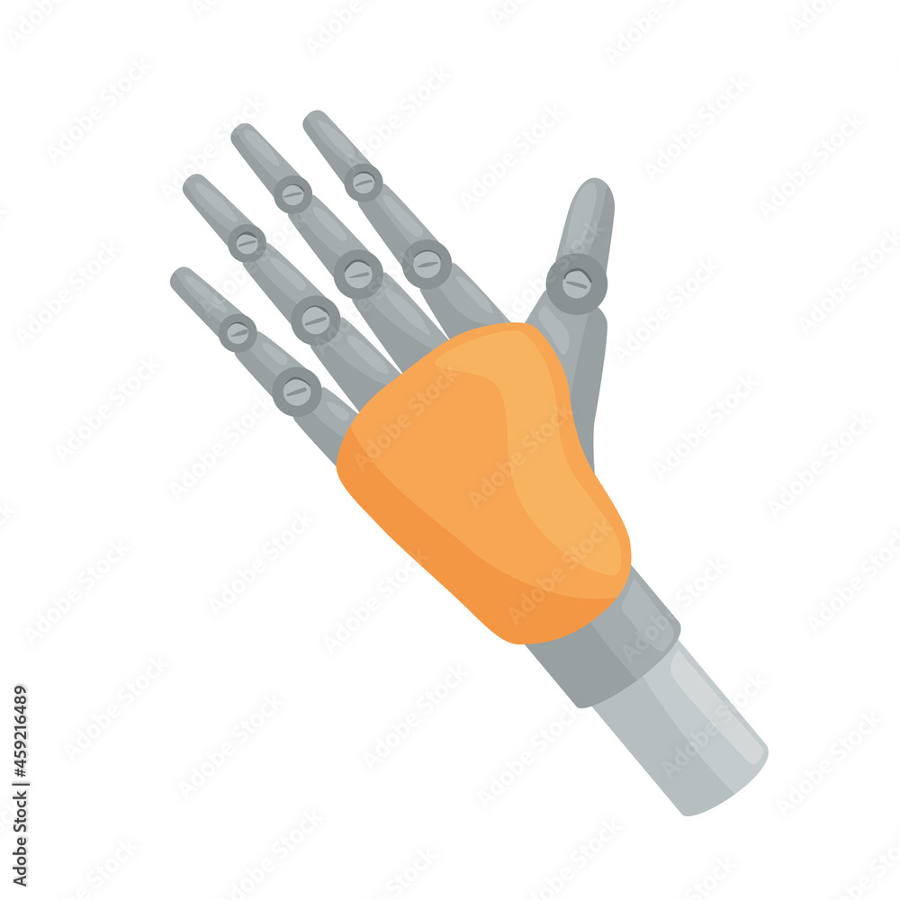 hand prosthesis implant hand prosthesis implant