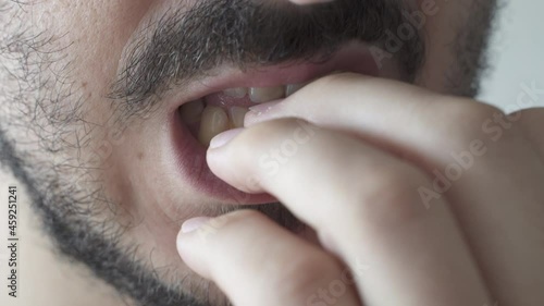 Extreme close up of young man biting his nails photo