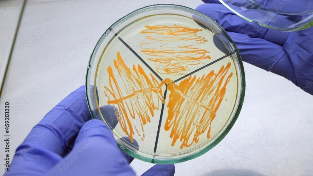 Video „The scientist opens a petri dish with separately grown orange