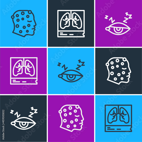 Set line Psoriasis or eczema rash, Insomnia and Lungs x-ray icon. Vector