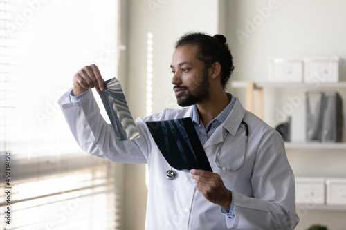 Serious young African American doctor examining radiography screening films of bones. Surgeon, radiologist reviewing xray scan of patient organs. Medical checkup, healthcare, radiology concept