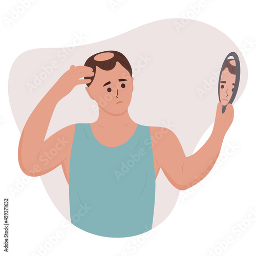 Man looking in the mirror at his baldness. Hair loss, alopecia in young age, hair problems. Vector illustration of a person with disease problems.