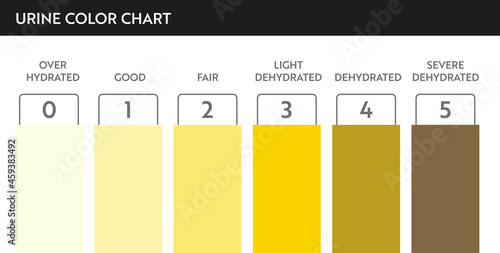 Urine color chart. Pee hydration and dehydration test strip. Vector design for medical education poster.