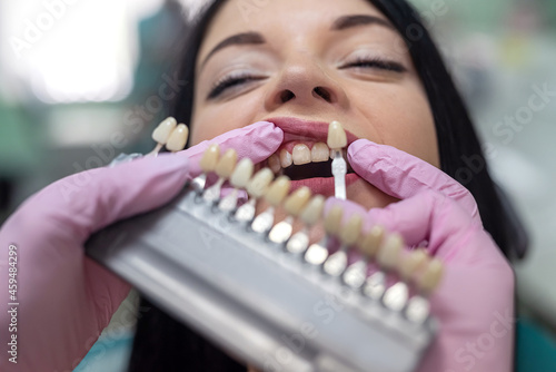 Patient in dentistry has chosen teeth color sampler