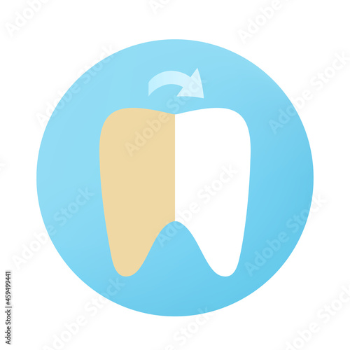 Teeth whitening design - before and after, vector illustration