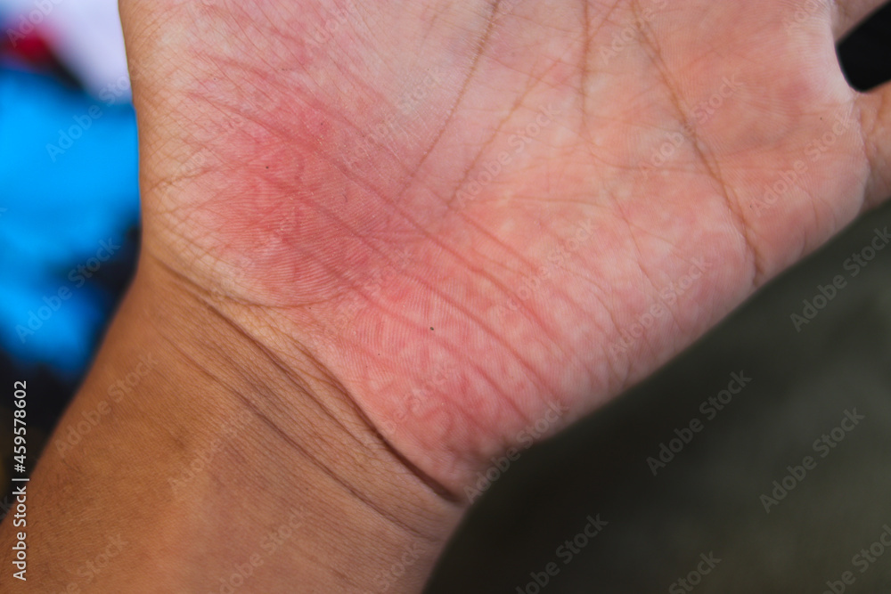 Fototapeta premium Red palms with carpet wrinkles