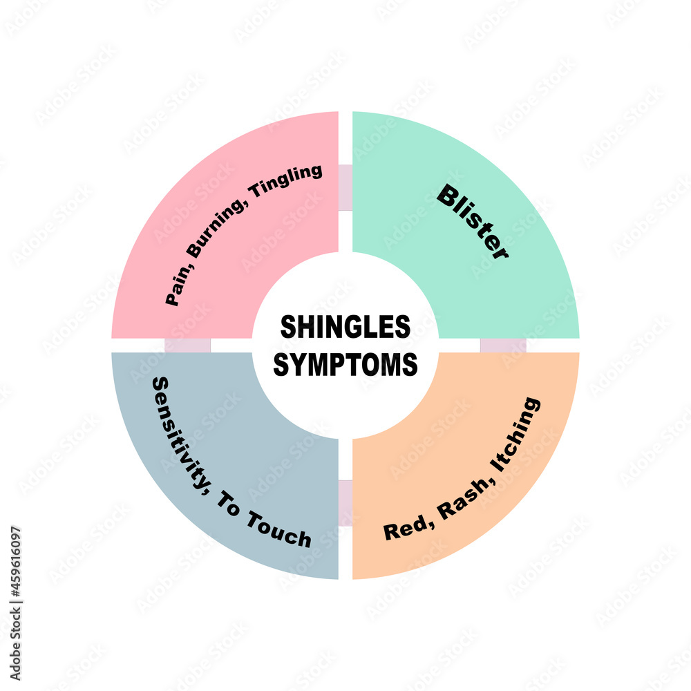 Diagram concept with Shingles Symptoms text and keywords. EPS 10 isolated on white background Diagram concept with Shingles Symptoms text and keywords. EPS 10 isolated on white background