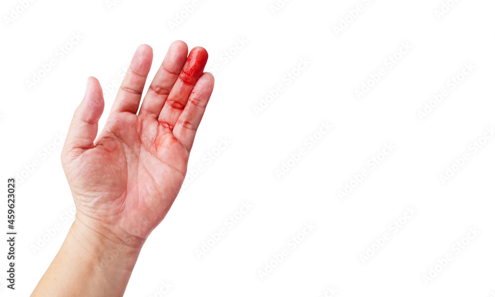 The wound was bleeding on the hand. unexpected accident isolated from the white background The wound was bleeding on the hand. unexpected accident isolated from the white background