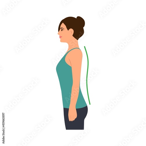 Correct and incorrect standing posture.Young woman with bad posture. Cervical spinal curvature. Hump. Good posture. Healthy back.Vector illustration on white background.
