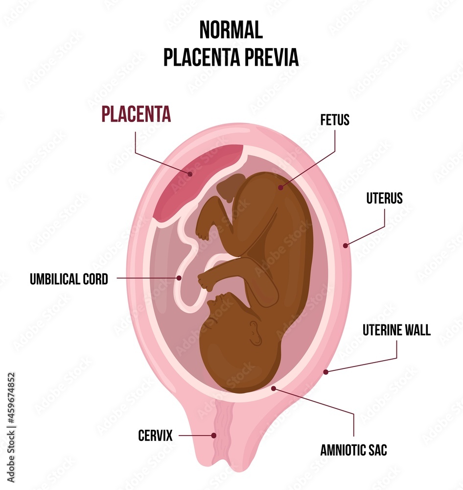 Obraz premium Normal Previa black