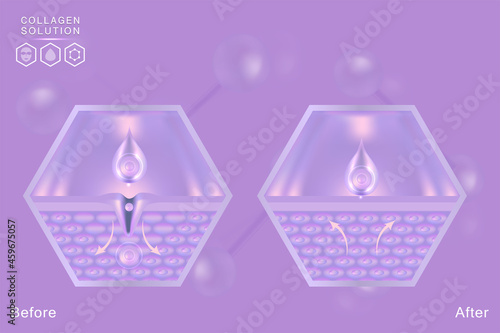 Hyaluronic acid before and after skin solutions ad, purple collagen serum drop with cosmetic advertising background ready to use, illustration vector.