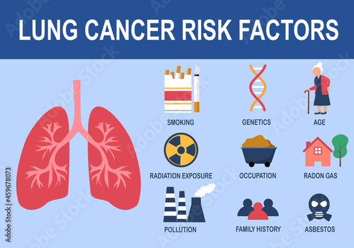 Lung cancer risk factors infographic vector illustration.