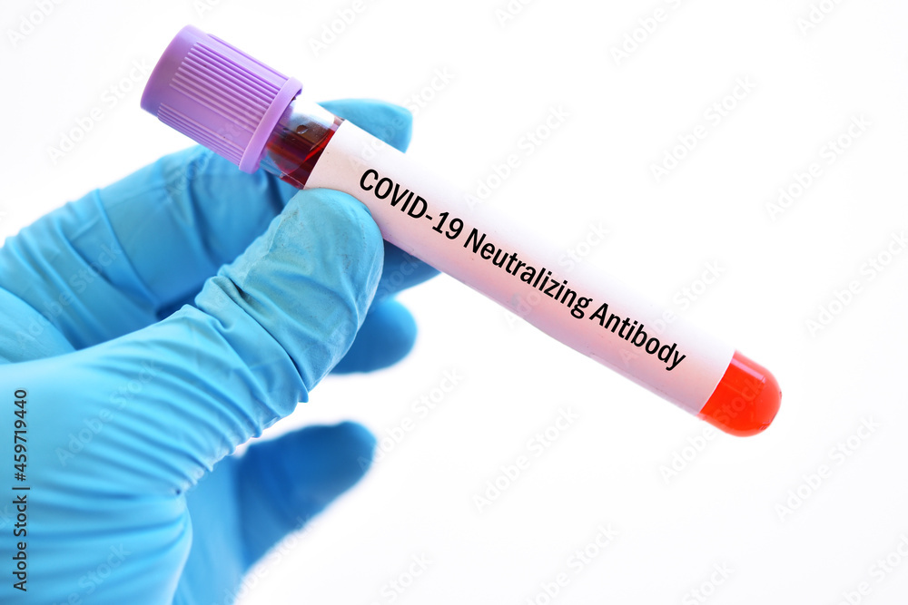 Obraz premium Test tube with blood sample for COVID-19 neutralizing antibody