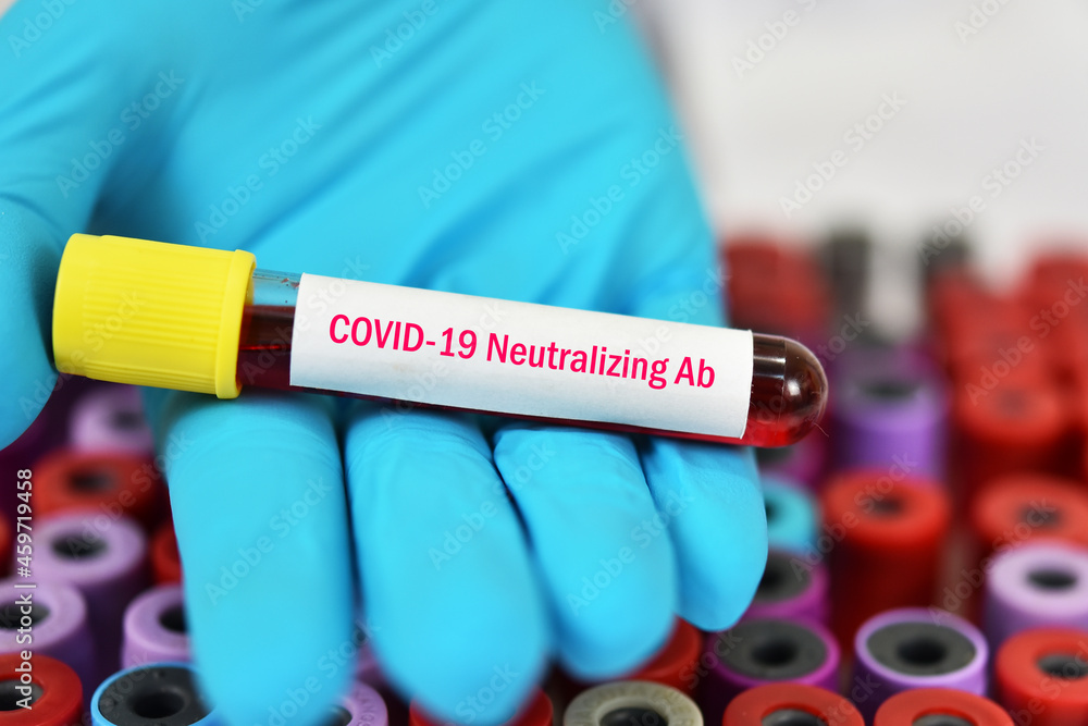 Fototapeta premium Test tube with blood sample for COVID-19 neutralizing antibody